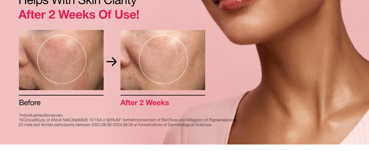 ANUA - Niacinamide 10% + TXA 4% Serum gallery image 5
