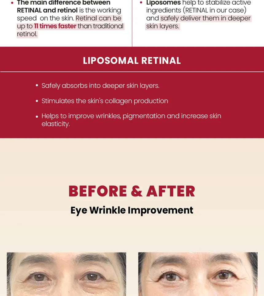 KSECRET - GLOBAL Eye Cream : Retinal Lipsome 4% + Fermented Bean gallery image 5