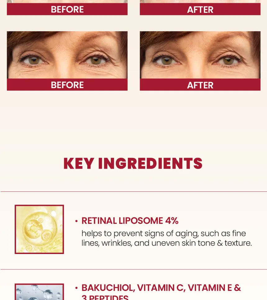 KSECRET - GLOBAL Eye Cream : Retinal Lipsome 4% + Fermented Bean gallery image 6