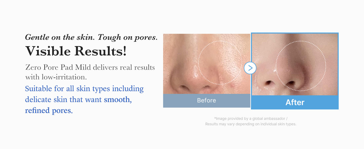medicube - Zero Pore Pad Mild gallery image 6